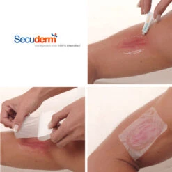 SURPANSEMENT ETANCHE SECUDERM 20x30CM L 10 SURPANSEMENT ETANCHE SECUDERM 20x30CM L -Magasin De Bateaux surpansement etanche secuderm 20x30cm l 3